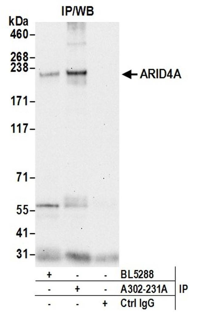 ARID4A Antibody in Western Blot (WB)