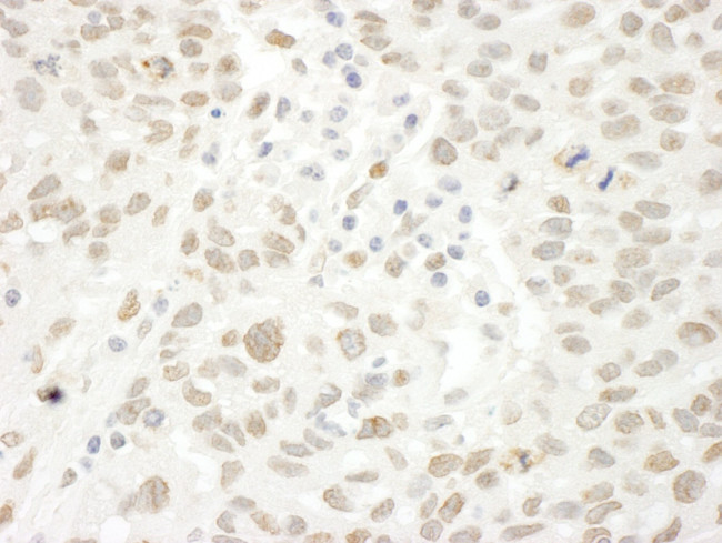 ARID4B Antibody in Immunohistochemistry (IHC)