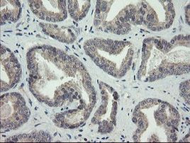 ARL2BP Antibody in Immunohistochemistry (Paraffin) (IHC (P))