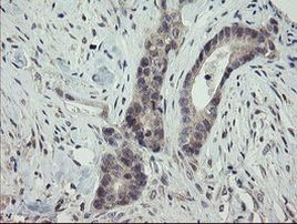 ARL2BP Antibody in Immunohistochemistry (Paraffin) (IHC (P))