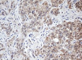 ARL2BP Antibody in Immunohistochemistry (Paraffin) (IHC (P))