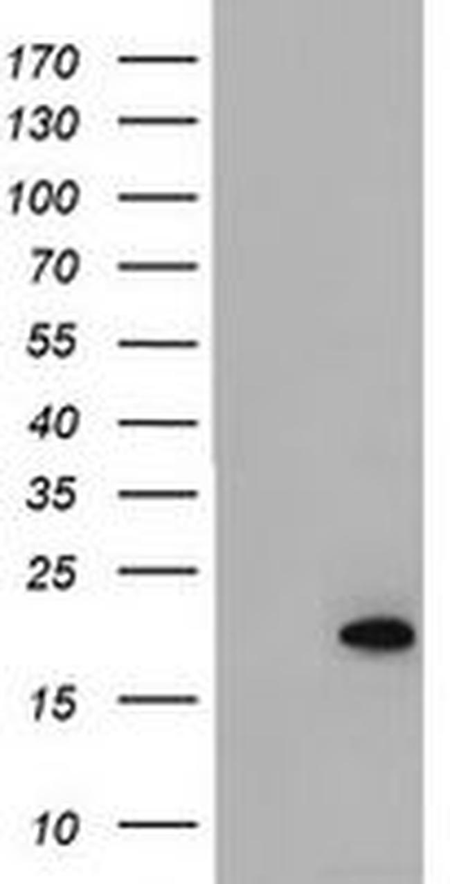 ARL2BP Antibody in Western Blot (WB)