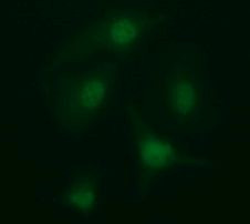 ARMC1 Antibody in Immunocytochemistry (ICC/IF)