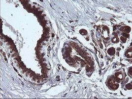 ARMC1 Antibody in Immunohistochemistry (Paraffin) (IHC (P))