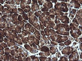 ARMC1 Antibody in Immunohistochemistry (Paraffin) (IHC (P))