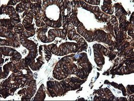 ARMC1 Antibody in Immunohistochemistry (Paraffin) (IHC (P))