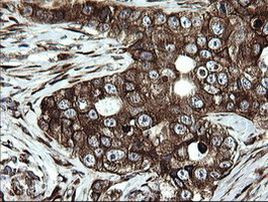 ARMC1 Antibody in Immunohistochemistry (Paraffin) (IHC (P))