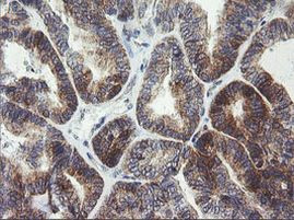 ARMC1 Antibody in Immunohistochemistry (Paraffin) (IHC (P))