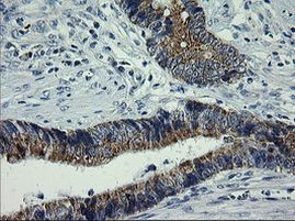 ARMC1 Antibody in Immunohistochemistry (Paraffin) (IHC (P))