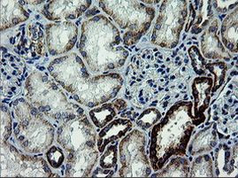 ARMC1 Antibody in Immunohistochemistry (Paraffin) (IHC (P))