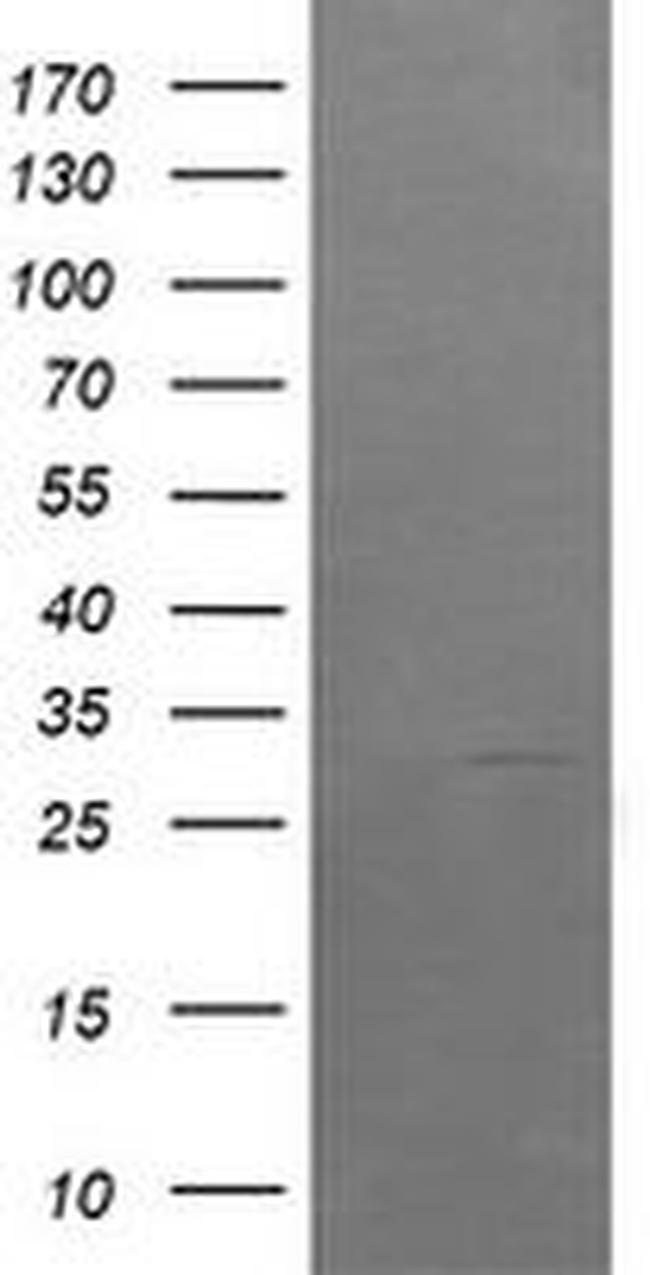 ARMC1 Antibody in Western Blot (WB)