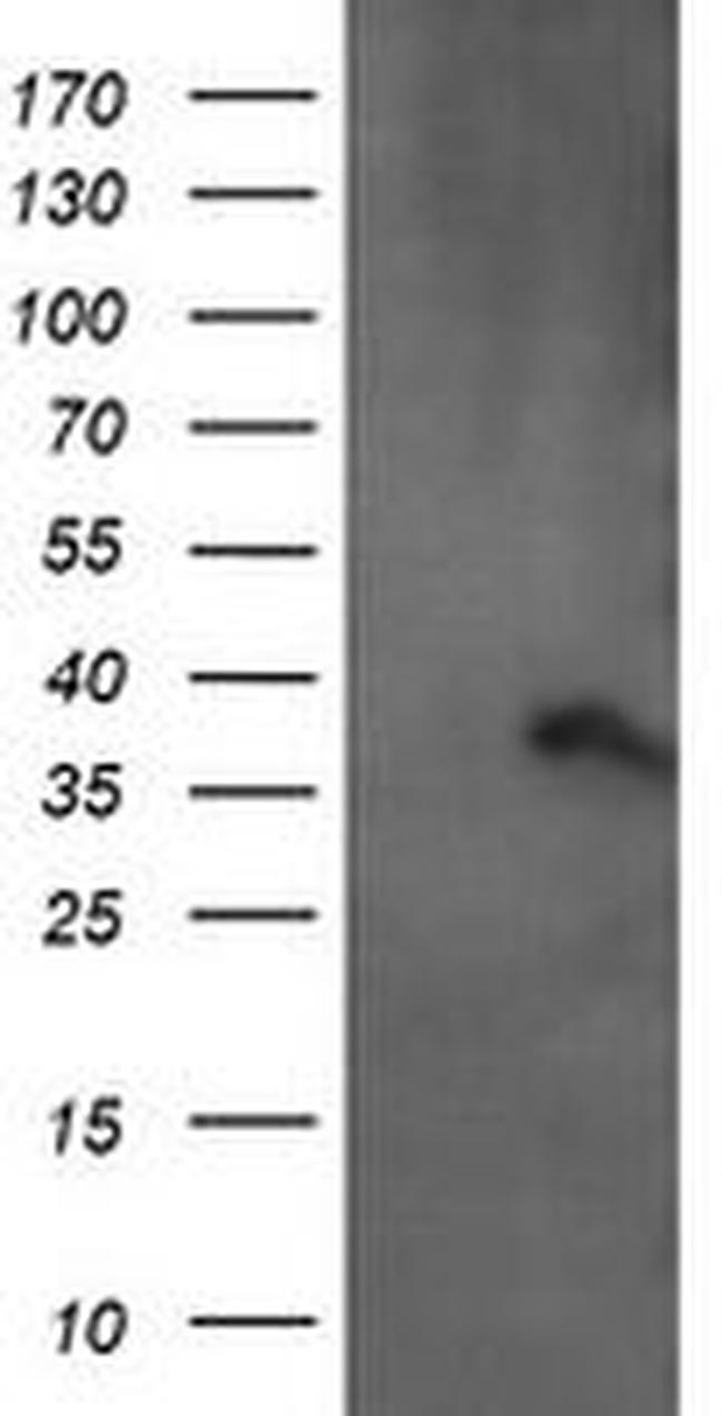 ARMC1 Antibody in Western Blot (WB)