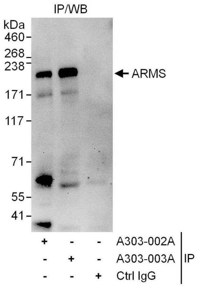 ARMS Antibody in Immunoprecipitation (IP)
