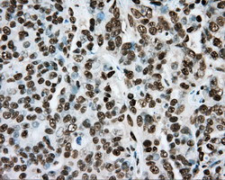 ARNT Antibody in Immunohistochemistry (Paraffin) (IHC (P))