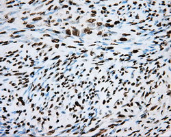 ARNT Antibody in Immunohistochemistry (Paraffin) (IHC (P))