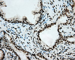 ARNT Antibody in Immunohistochemistry (Paraffin) (IHC (P))