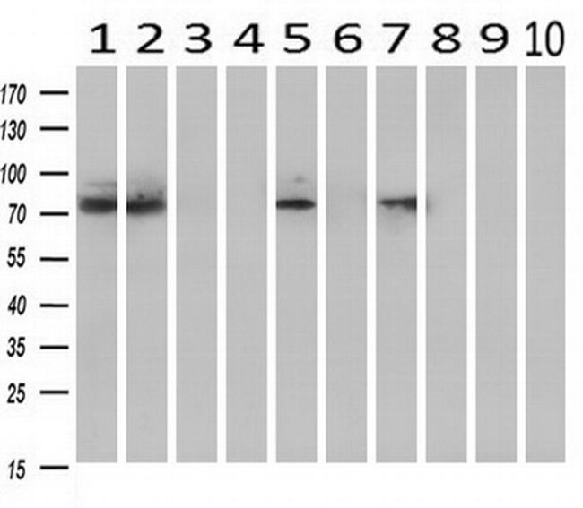 ARNT Antibody in Western Blot (WB)