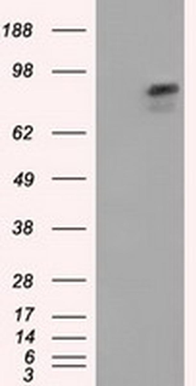 ARNT Antibody in Western Blot (WB)