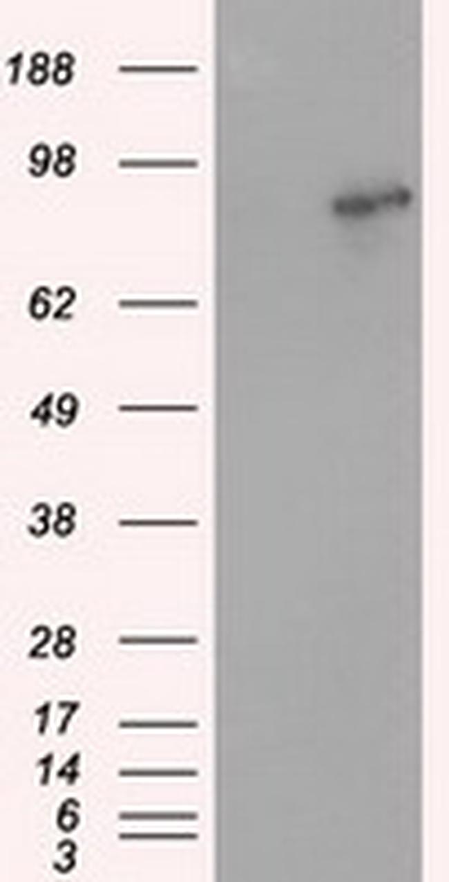 ARNT Antibody in Western Blot (WB)