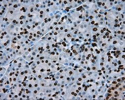 ARNTL Antibody in Immunohistochemistry (Paraffin) (IHC (P))