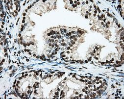 ARNTL Antibody in Immunohistochemistry (Paraffin) (IHC (P))