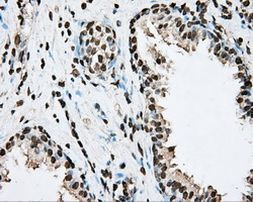 ARNTL Antibody in Immunohistochemistry (Paraffin) (IHC (P))