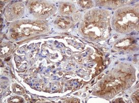 ARPC5 Antibody in Immunohistochemistry (Paraffin) (IHC (P))