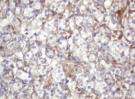 ARPC5 Antibody in Immunohistochemistry (Paraffin) (IHC (P))