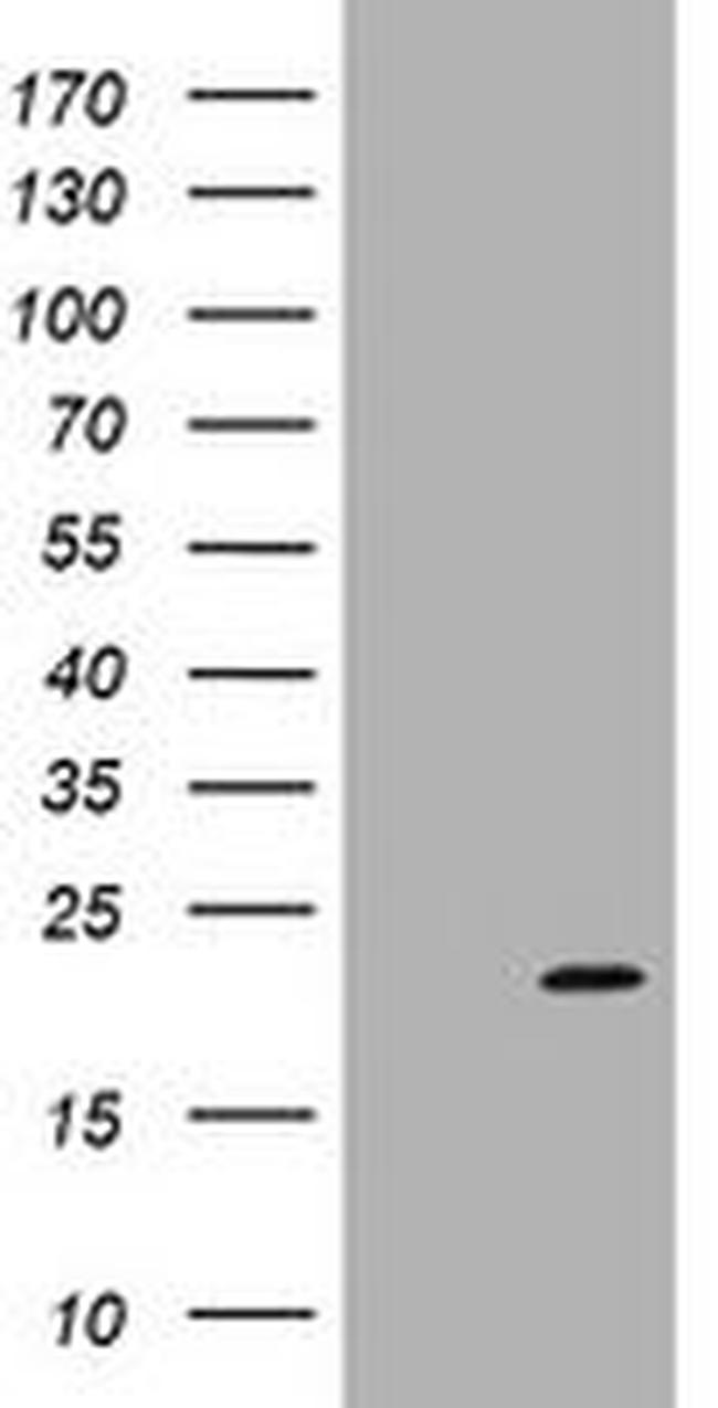 ARPC5 Antibody in Western Blot (WB)