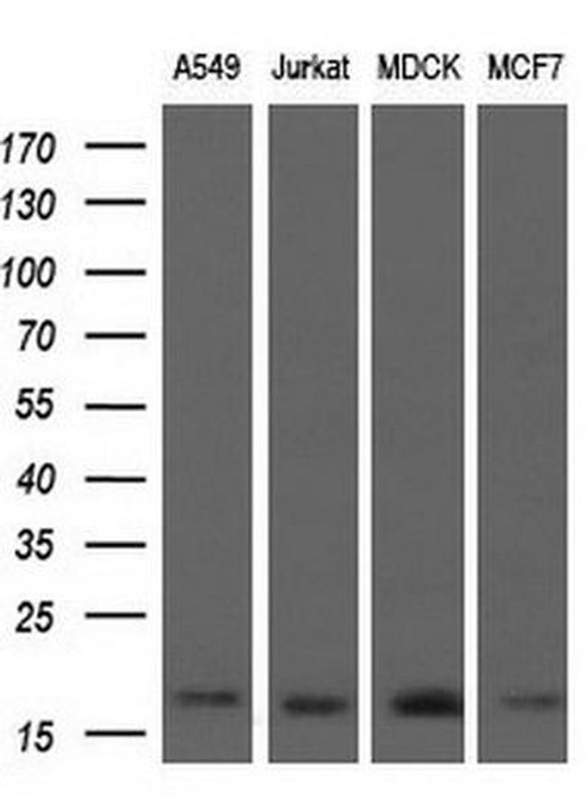 ARPC5 Antibody in Western Blot (WB)