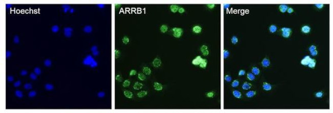 beta Arrestin 1 Antibody in Immunocytochemistry (ICC/IF)