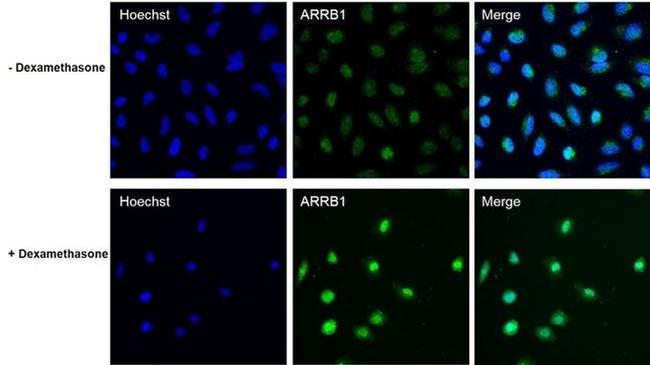 beta Arrestin 1 Antibody