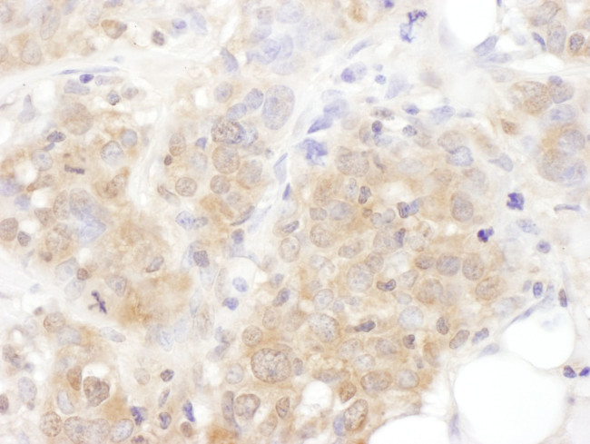 AS160 Antibody in Immunohistochemistry (IHC)