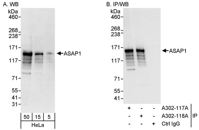 ASAP1 Antibody in Western Blot (WB)