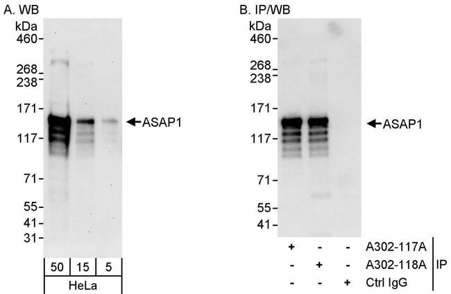 ASAP1 Antibody in Western Blot (WB)