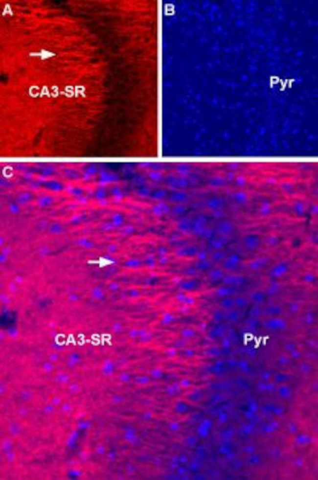 SCN2A (NaV1.2) Antibody in Immunohistochemistry (IHC)