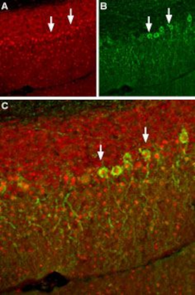 Pan NaV Antibody in Immunohistochemistry (IHC)