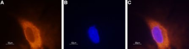 SCN3A (NaV1.3) Antibody in Immunocytochemistry (ICC/IF)