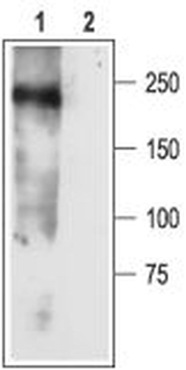 SCN3A (NaV1.3) Antibody in Western Blot (WB)