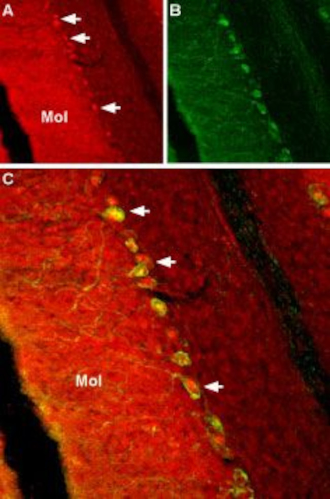 SCN2B (NaV beta 2) Antibody in Immunohistochemistry (IHC)