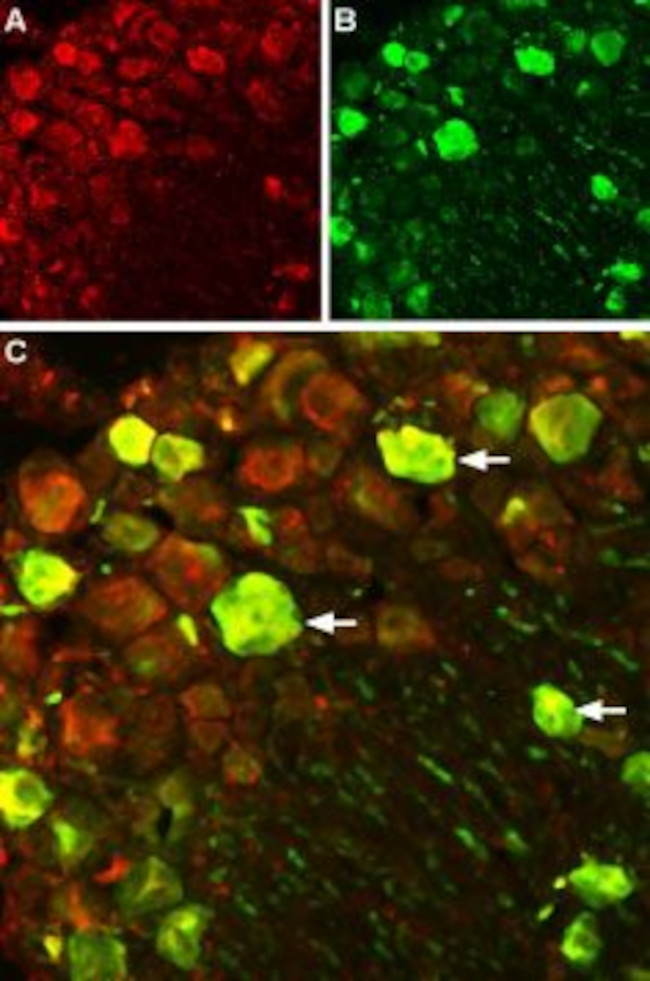 NaV1.7 (SCN9A) Antibody in Immunohistochemistry (IHC)