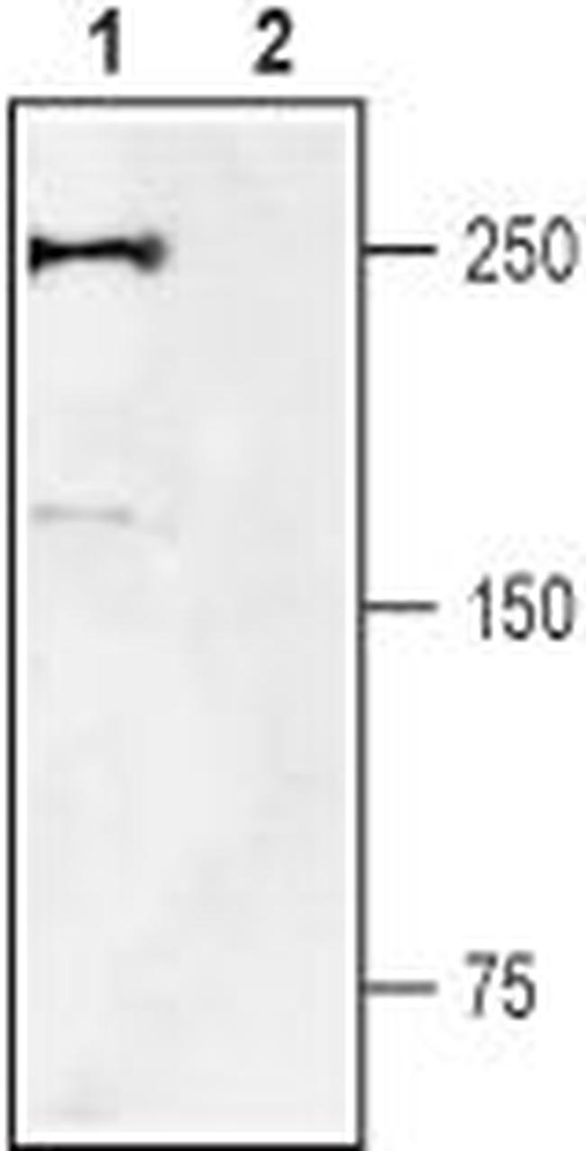 NaV1.7 (SCN9A) Antibody in Western Blot (WB)