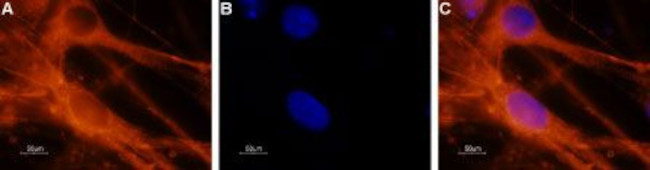 NaV1.6 (SCN8A) Antibody in Immunocytochemistry (ICC/IF)