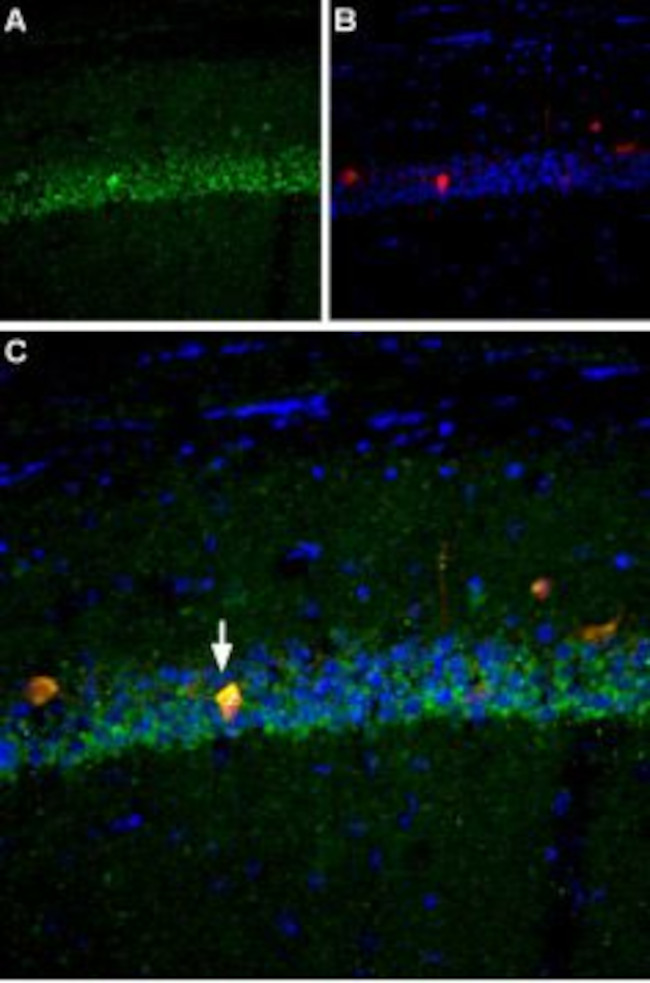 NaV1.6 (SCN8A) Antibody in Immunohistochemistry (IHC)