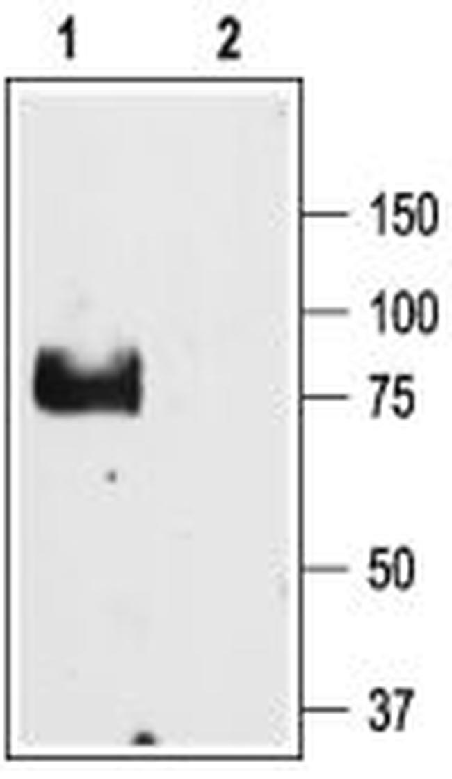 ENaC gamma (SCNN1G) (extracellular) Antibody in Western Blot (WB)