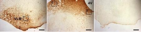 ASIC1 Antibody in Immunohistochemistry (IHC)