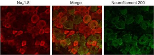 NaV1.8 (SCN10A) Antibody in Immunohistochemistry (IHC)