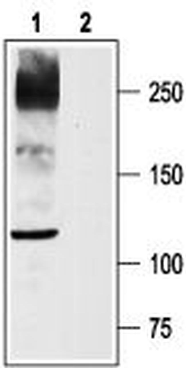 NaV1.8 (SCN10A) Antibody in Western Blot (WB)