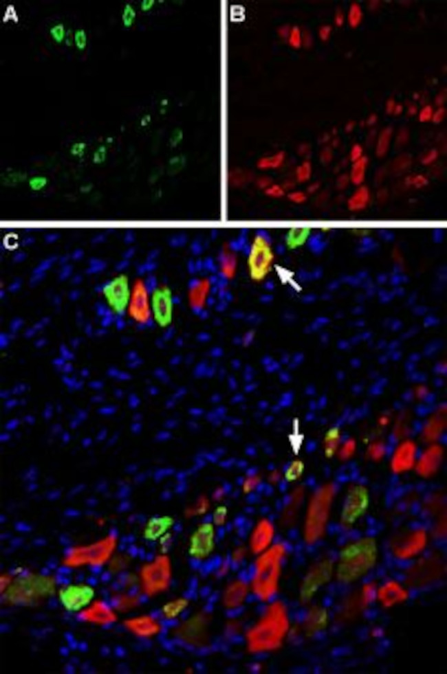 NaV1.8 (SCN10A) Antibody in Immunohistochemistry (Frozen) (IHC (F))