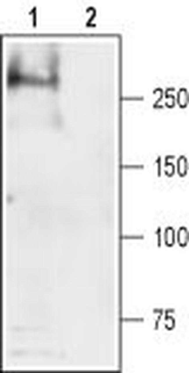 SCN4A (NaV1.4) Antibody in Western Blot (WB)